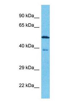 FAM131B Antibody - Western blot of FAM131B Antibody with human 721_B Whole Cell lysate.  This image was taken for the unconjugated form of this product. Other forms have not been tested.