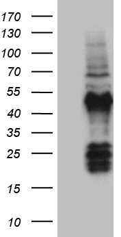 FAM131C Antibody - HEK293T cells were transfected with the pCMV6-ENTRY control. (Left lane) or pCMV6-ENTRY FAM131C. (Right lane) cDNA for 48 hrs and lysed. Equivalent amounts of cell lysates. (5 ug per lane) were separated by SDS-PAGE and immunoblotted with anti-FAM131C. (1:2000)