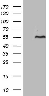 FAM131C Antibody - HEK293T cells were transfected with the pCMV6-ENTRY control. (Left lane) or pCMV6-ENTRY FAM131C. (Right lane) cDNA for 48 hrs and lysed