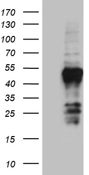 FAM131C Antibody - HEK293T cells were transfected with the pCMV6-ENTRY control. (Left lane) or pCMV6-ENTRY FAM131C. (Right lane) cDNA for 48 hrs and lysed. Equivalent amounts of cell lysates. (5 ug per lane) were separated by SDS-PAGE and immunoblotted with anti-FAM131C. (1:2000)