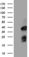FAM131C Antibody - HEK293T cells were transfected with the pCMV6-ENTRY control. (Left lane) or pCMV6-ENTRY FAM131C. (Right lane) cDNA for 48 hrs and lysed