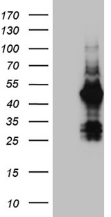 FAM131C Antibody - HEK293T cells were transfected with the pCMV6-ENTRY control. (Left lane) or pCMV6-ENTRY FAM131C. (Right lane) cDNA for 48 hrs and lysed. Equivalent amounts of cell lysates. (5 ug per lane) were separated by SDS-PAGE and immunoblotted with anti-FAM131C. (1:2000)