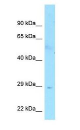 FAM133B Antibody - FAM133B antibody Western Blot of Human Small Intestine.  This image was taken for the unconjugated form of this product. Other forms have not been tested.
