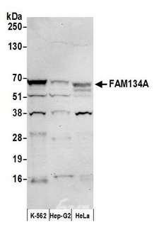 FAM134A Antibody - Detection of human FAM134A by western blot. Samples: Whole cell lysate (50 µg) from K-562, Hep-G2, and HeLa cells prepared using NETN lysis buffer. Antibody: Affinity purified rabbit anti-FAM134A antibody used for WB at 1:1000. Detection: Chemiluminescence with an exposure time of 30 seconds.