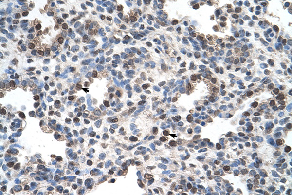 FAM134B Antibody - FAM134B antibody ARP44827_T100-NP_061873-FAM134B Antibody IHC of formalin-fixed, paraffin-embedded human Lung. Positive label: Alveolar cells indicated with arrows. Antibody concentration 4-8 ug/ml. Magnification 400X.  This image was taken for the unconjugated form of this product. Other forms have not been tested.