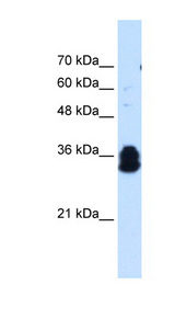 FAM134B Antibody - FAM134B antibody ARP44827_T100-NP_061873-FAM134B Antibody Western blot of Jurkat lysate.  This image was taken for the unconjugated form of this product. Other forms have not been tested.