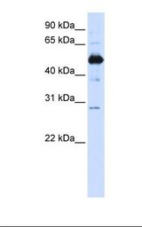 FAM134B Antibody - Transfected 293T cell lysate. Antibody concentration: 1.0 ug/ml. Gel concentration: 12%.  This image was taken for the unconjugated form of this product. Other forms have not been tested.