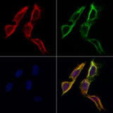 FAM134B Antibody - Staining HeLa cells by IF/ICC. The samples were fixed with PFA and permeabilized in 0.1% Triton X-100, then blocked in 10% serum for 45 min at 25°C. Samples were then incubated with primary Ab(1:200) and mouse anti-beta tubulin Ab(1:200) for 1 hour at 37°C. An AlexaFluor594 conjugated goat anti-rabbit IgG(H+L) Ab(1:200 Red) and an AlexaFluor488 conjugated goat anti-mouse IgG(H+L) Ab(1:600 Green) were used as the secondary antibod
