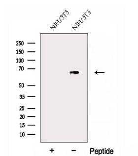 FAM134B Antibody