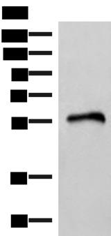 FAM134B Antibody - Western blot analysis of Human heart tissue lysate  using RETREG1 Polyclonal Antibody at dilution of 1:400