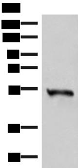 FAM134B Antibody - Western blot analysis of Human heart tissue lysate  using RETREG1 Polyclonal Antibody at dilution of 1:300