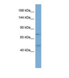 FAM13A1 / KIAA0914 Antibody - Western blot of Human OVCAR-3. FAM13A antibody dilution 1.0 ug/ml.  This image was taken for the unconjugated form of this product. Other forms have not been tested.
