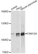 FAM13A1 / KIAA0914 Antibody - Western blot analysis of extracts of various cell lines, using FAM13A antibody at 1:1000 dilution. The secondary antibody used was an HRP Goat Anti-Rabbit IgG (H+L) at 1:10000 dilution. Lysates were loaded 25ug per lane and 3% nonfat dry milk in TBST was used for blocking. An ECL Kit was used for detection and the exposure time was 5s.