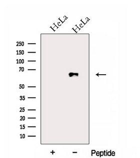 FAM13A1 / KIAA0914 Antibody - Western blot analysis of extracts of 293T cells using FAM13A antibody. The lane on the left was treated with blocking peptide.