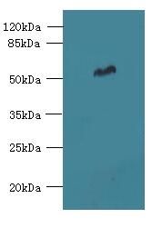 FAM149B1 Antibody - Western blot. All lanes: FAM149B1 antibody at 3 ug/ml+ Mouse liver tissue Goat polyclonal to rabbit at 1:10000 dilution. Predicted band size: 65 kDa. Observed band size: 65 kDa.