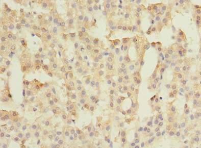 FAM149B1 Antibody - Immunohistochemistry of paraffin-embedded human adrenal gland tissue using antibody at dilution of 1:100.