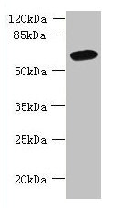 FAM149B1 Antibody - Western blot All lanes: FAM149B1 antibody at 3µg/ml + Mouse liver tissue Secondary Goat polyclonal to rabbit IgG at 1/10000 dilution Predicted band size: 65, 59 kDa Observed band size: 65 kDa