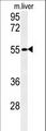 FAM151A Antibody - Western blot of FAM151A Antibody in mouse liver tissue lysates (35 ug/lane). FAM151A (arrow) was detected using the purified antibody.