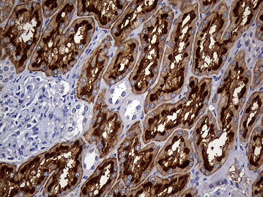 FAM151B Antibody - Immunohistochemical staining of paraffin-embedded Human Kidney tissue within the normal limits using anti-FAM151B mouse monoclonal antibody. (Heat-induced epitope retrieval by 1mM EDTA in 10mM Tris buffer. (pH8.5) at 120°C for 3 min. (1:500)