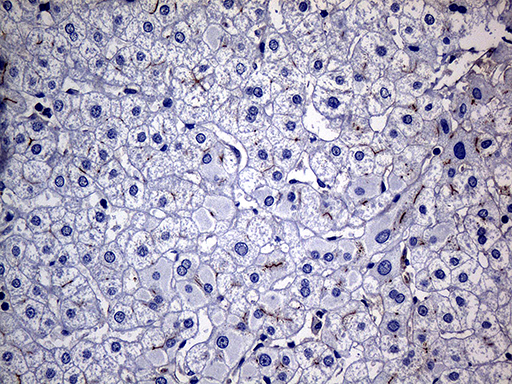 FAM151B Antibody - Immunohistochemical staining of paraffin-embedded Human liver tissue within the normal limits using anti-FAM151B mouse monoclonal antibody. (Heat-induced epitope retrieval by 1mM EDTA in 10mM Tris buffer. (pH8.5) at 120°C for 3 min. (1:500)