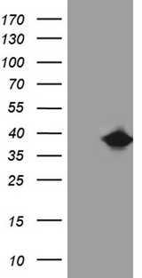 FAM151B Antibody - HEK293T cells were transfected with the pCMV6-ENTRY control. (Left lane) or pCMV6-ENTRY FAM151B. (Right lane) cDNA for 48 hrs and lysed. Equivalent amounts of cell lysates. (5 ug per lane) were separated by SDS-PAGE and immunoblotted with anti-FAM151B. (1:2000)