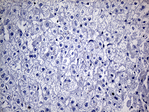FAM151B Antibody - Immunohistochemical staining of paraffin-embedded Human liver tissue within the normal limits using anti-FAM151B mouse monoclonal antibody.This figure shows negative staining. (Heat-induced epitope retrieval by 1mM EDTA in 10mM Tris buffer. (pH8.5) at 120°C for 3 min. (1:500)