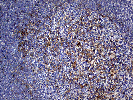 FAM151B Antibody - Immunohistochemical staining of paraffin-embedded Human tonsil within the normal limits using anti-FAM151B mouse monoclonal antibody. (Heat-induced epitope retrieval by 1mM EDTA in 10mM Tris buffer. (pH8.5) at 120°C for 3 min. (1:500)