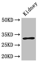 FAM151B Antibody - Western Blot Positive WB detected in: Mouse kidney tissue All lanes: FAM151B antibody at 2.6µg/ml Secondary Goat polyclonal to rabbit IgG at 1/50000 dilution Predicted band size: 32 kDa Observed band size: 32 kDa