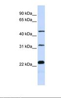 FAM153B Antibody - Jurkat cell lysate. Antibody concentration: 1.0 ug/ml. Gel concentration: 12%.  This image was taken for the unconjugated form of this product. Other forms have not been tested.