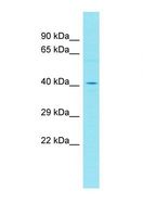 FAM153B Antibody - Western blot of Human MDA-MB-435s. FAM153B antibody dilution 1.0 ug/ml.  This image was taken for the unconjugated form of this product. Other forms have not been tested.