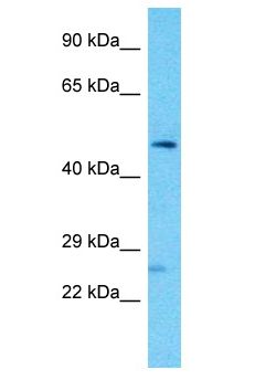 FAM155A Antibody - FAM155A antibody Western Blot of PANC1. Antibody dilution: 1 ug/ml.  This image was taken for the unconjugated form of this product. Other forms have not been tested.