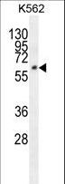 FAM155A Antibody - FAM155A Antibody western blot of K562 cell line lysates (35 ug/lane). The FAM155A antibody detected the FAM155A protein (arrow).