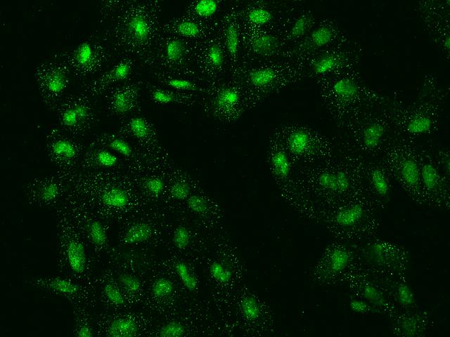 FAM155A Antibody - Immunofluorescence staining of FAM155A in U2OS cells. Cells were fixed with 4% PFA, permeabilzed with 0.1% Triton X-100 in PBS, blocked with 10% serum, and incubated with rabbit anti-Human FAM155A polyclonal antibody (dilution ratio 1:200) at 4°C overnight. Then cells were stained with the Alexa Fluor 488-conjugated Goat Anti-rabbit IgG secondary antibody (green). Positive staining was localized to Nucleus and Cytoplasm.