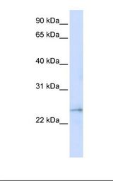 FAM156A / TMEM29 Antibody - MCF7 cell lysate. Antibody concentration: 1.0 ug/ml. Gel concentration: 12%.  This image was taken for the unconjugated form of this product. Other forms have not been tested.