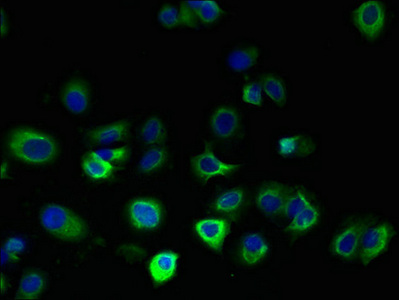 FAM156A / TMEM29 Antibody - Immunofluorescent analysis of MCF-7 cells using FAM156A Antibody at dilution of 1:100 and Alexa Fluor 488-congugated AffiniPure Goat Anti-Rabbit IgG(H+L)