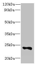 FAM156A / TMEM29 Antibody - Western blot All lanes: FAM156A antibody at 5µg/ml + Mouse heart tissue Secondary Goat polyclonal to rabbit IgG at 1/10000 dilution Predicted band size: 25 kDa Observed band size: 25 kDa