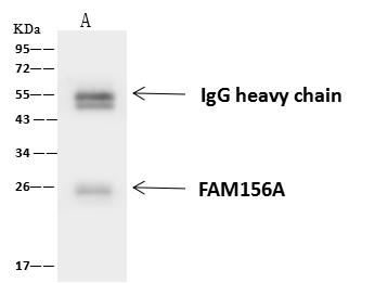 FAM156A / TMEM29 Antibody - FAM156A was immunoprecipitated using: Lane A: 0.5 mg U-251 MG Whole Cell Lysate. 4 uL anti-FAM156A rabbit polyclonal antibody and 60 ug of Immunomagnetic beads Protein A/G. Primary antibody: Anti-FAM156A rabbit polyclonal antibody, at 1:100 dilution. Secondary antibody: Goat Anti-Rabbit IgG (H+L)/HRP at 1/10000 dilution. Developed using the ECL technique. Performed under reducing conditions. Predicted band size: 24 kDa. Observed band size: 24 kDa.