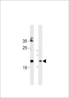 FAM159A Antibody - FAM159A Antibody western blot of HeLa cell line and mouse bladder tissue lysates (35 ug/lane). The FAM159A antibody detected the FAM159A protein (arrow).