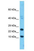 FAM159B Antibody - FAM159B antibody Western Blot of 721_B. Antibody dilution: 1 ug/ml.  This image was taken for the unconjugated form of this product. Other forms have not been tested.