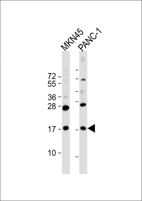 FAM159B Antibody - All lanes: Anti-FAM159B Antibody (C-Term) at 1:2000 dilution Lane 1: MKN45 whole cell lysate Lane 2: PANC-1 whole cell lysate Lysates/proteins at 20 µg per lane. Secondary Goat Anti-Rabbit IgG, (H+L), Peroxidase conjugated at 1/10000 dilution. Predicted band size: 18 kDa Blocking/Dilution buffer: 5% NFDM/TBST.