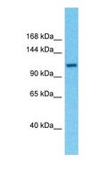 FAM160A2 / C11orf56 Antibody - Western blot of FAM160A2 Antibody with human THP-1 Whole Cell lysate.  This image was taken for the unconjugated form of this product. Other forms have not been tested.