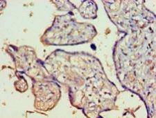 FAM160B1 Antibody - Immunohistochemistry of paraffin-embedded human placenta tissue using antibody at 1:100 dilution.  This image was taken for the unconjugated form of this product. Other forms have not been tested.