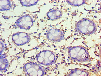 FAM160B1 Antibody - Immunohistochemistry of paraffin-embedded human rectum tissue using FAM160B1 Antibody at dilution of 1:100