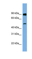 FAM160B1 Antibody - FAM160B1 antibody Western blot of Jurkat lysate. This image was taken for the unconjugated form of this product. Other forms have not been tested.