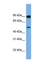 FAM160B1 Antibody - FAM160B1 antibody Western blot of Jurkat lysate. This image was taken for the unconjugated form of this product. Other forms have not been tested.
