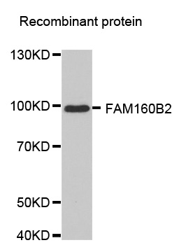 FAM160B2 / RAI16 Antibody - Western blot analysis of extracts of recombinant protein.