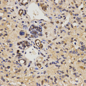 FAM160B2 / RAI16 Antibody - Immunohistochemistry of paraffin-embedded mouse liver fibrosis tissue.