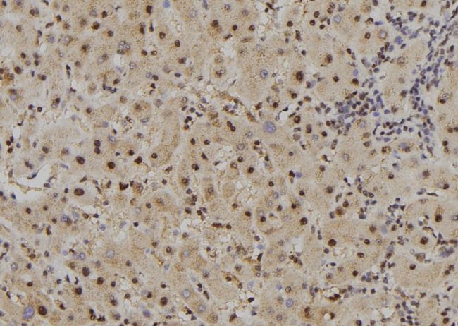 FAM160B2 / RAI16 Antibody - 1:100 staining human liver tissue by IHC-P. The sample was formaldehyde fixed and a heat mediated antigen retrieval step in citrate buffer was performed. The sample was then blocked and incubated with the antibody for 1.5 hours at 22°C. An HRP conjugated goat anti-rabbit antibody was used as the secondary.