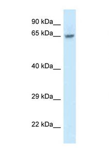 FAM161A Antibody - FAM161A antibody Western blot of Jurkat Cell lysate. Antibody concentration 1 ug/ml.  This image was taken for the unconjugated form of this product. Other forms have not been tested.