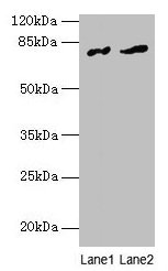 FAM161A Antibody - Western blot All lanes: FAM161A antibody at 8µg/ml Lane 1: Human placenta tissue Lane 2: Mouse liver tissueSecondary Goat polyclonal to rabbit IgG at 1/10000 dilution Predicted band size: 77, 65, 84 kDa Observed band size: 77 kDa